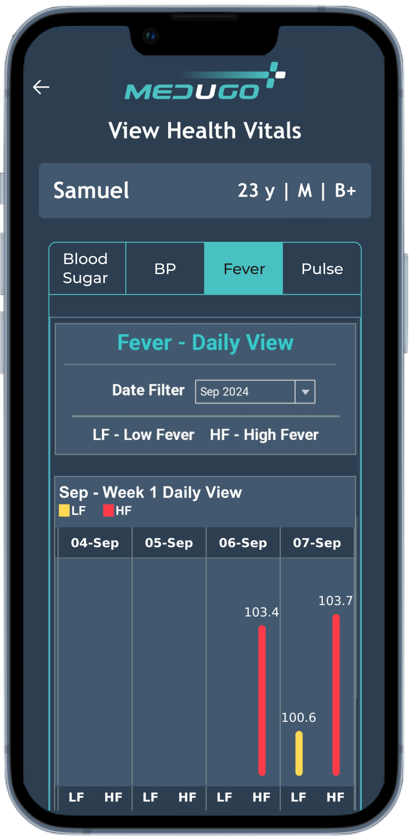 Fever